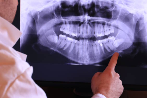 Best Emergency Tooth Extraction in Southern Pines, NC