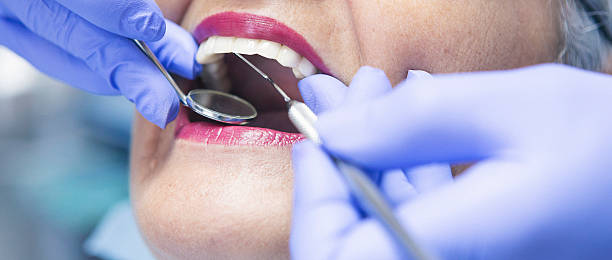 Best Emergency Wisdom Teeth Removal in Southern Pines, NC